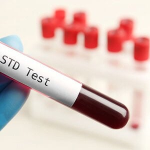 STD test blood sample vial held by a gloved hand at a clinic
